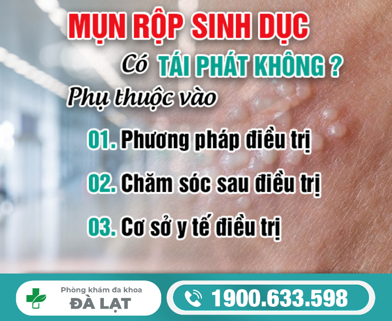 Hình ảnh minh họa